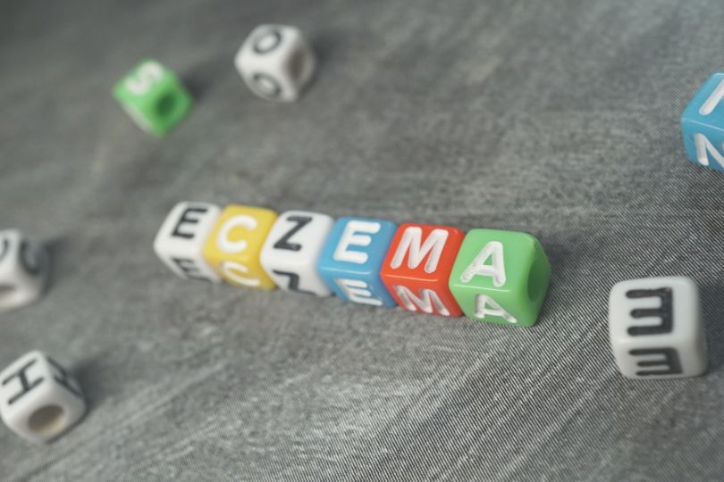 Do food allergies cause eczema? Here are the facts!