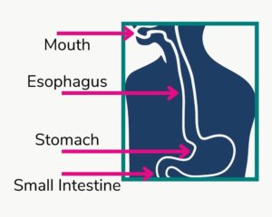 EOE is a food allergy that affects the esophagus.