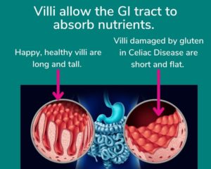 celiac disease