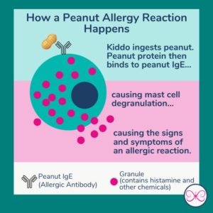 IgE-mediated life threatening food allergy reactions involve mast cells, IgE, and the food allergen.
